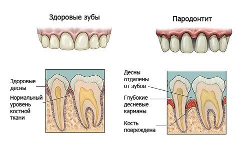 Лечение пародонтоза Томск Заречный уч-к стоматология бесплатно по полису томск